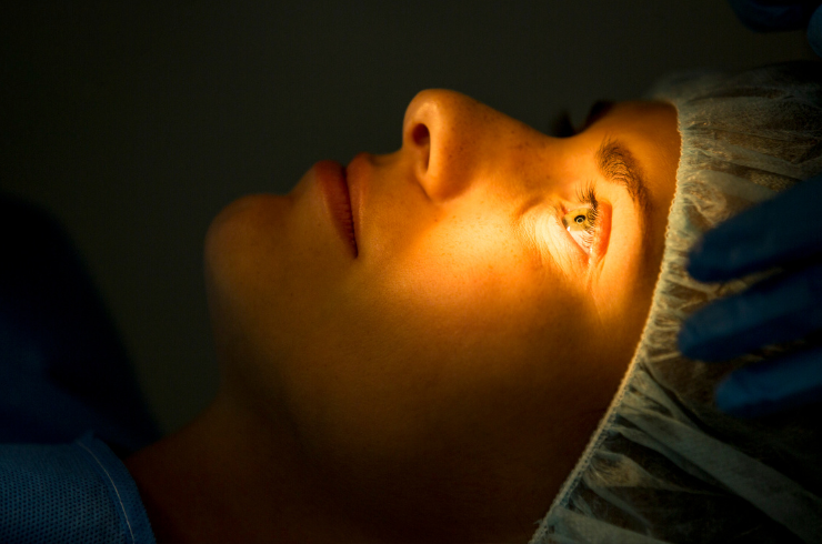 Refractive Surgery